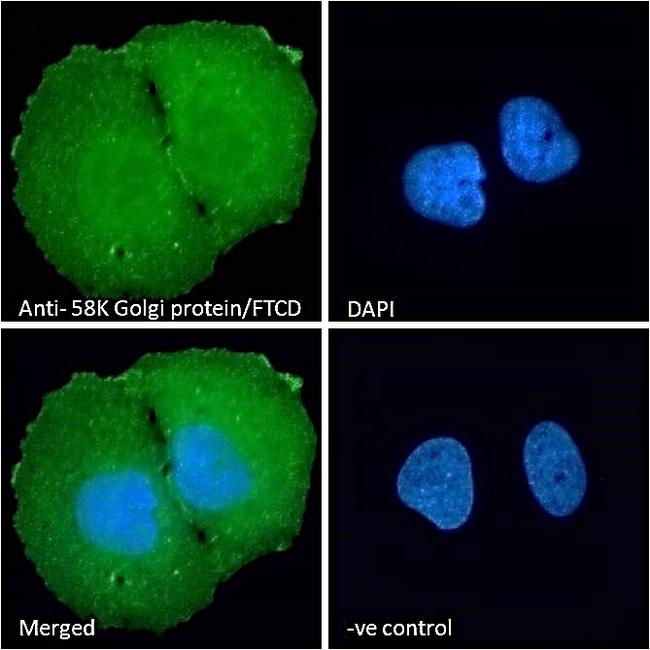 Golgi protein 58k Antibody in Immunocytochemistry (ICC/IF)