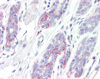 ERAB Antibody in Immunohistochemistry (Paraffin) (IHC (P))