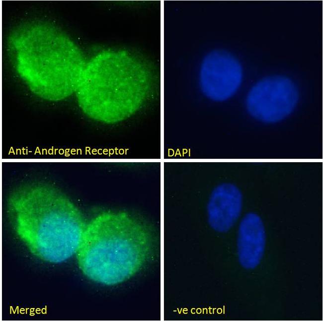 Androgen Receptor Antibody in Immunocytochemistry (ICC/IF)