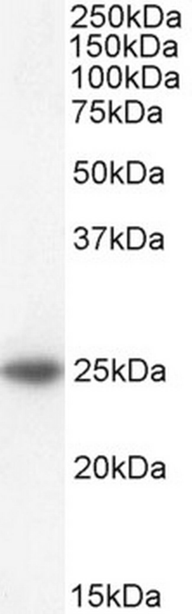 BAK Antibody in Western Blot (WB)