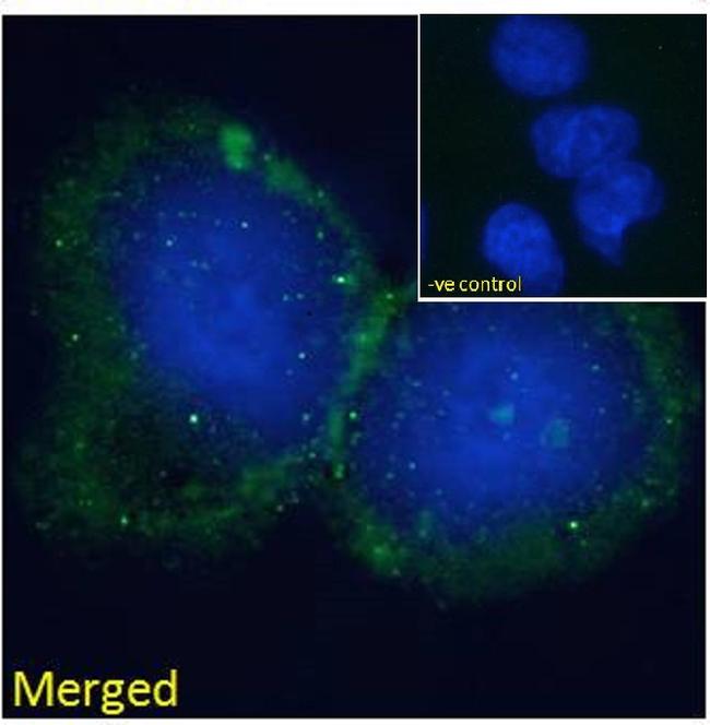 BLNK Antibody in Immunocytochemistry (ICC/IF)