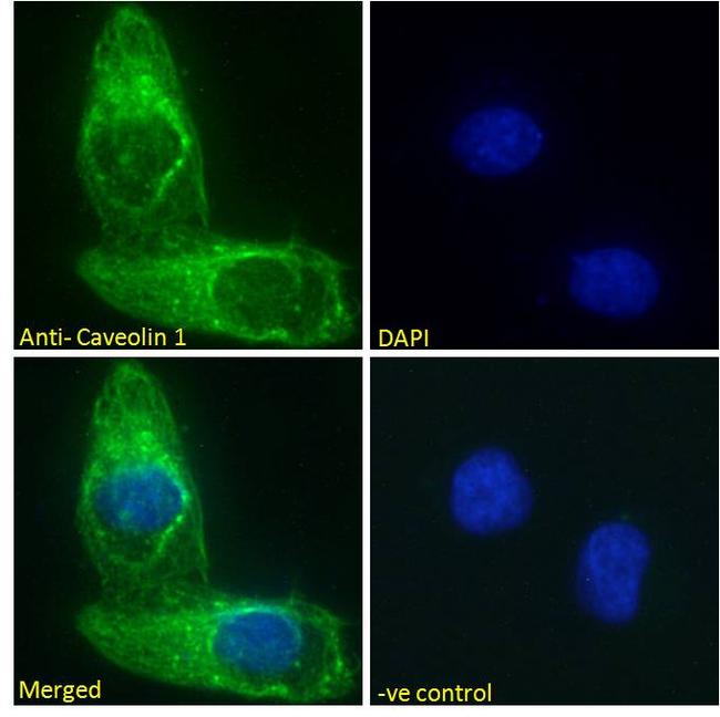 Caveolin 1 Antibody in Immunocytochemistry (ICC/IF)