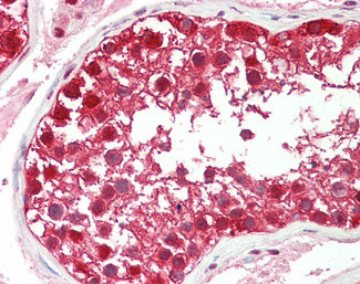 DDB1 Antibody in Immunohistochemistry (Paraffin) (IHC (P))