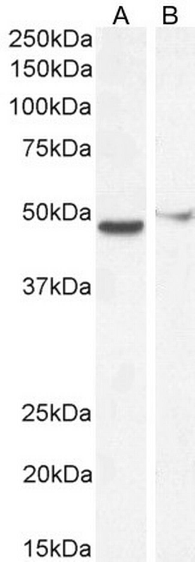 FOXG1 Antibody in Western Blot (WB)