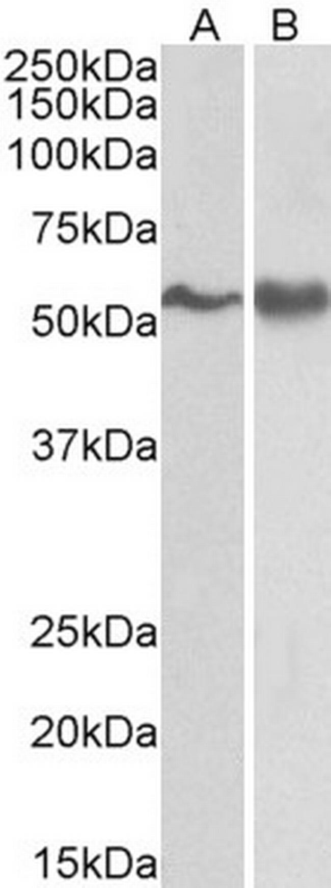 Fyn Antibody in Western Blot (WB)