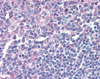 IRF8 Antibody in Immunohistochemistry (Paraffin) (IHC (P))