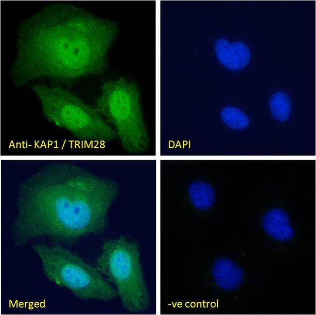 TRIM28 Antibody in Immunocytochemistry (ICC/IF)