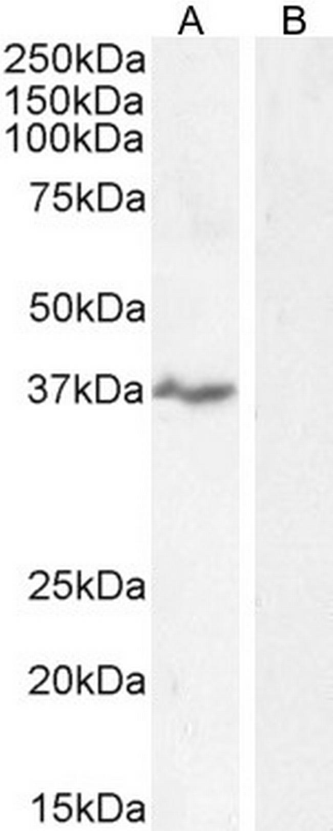 NKG2D Antibody in Western Blot (WB)