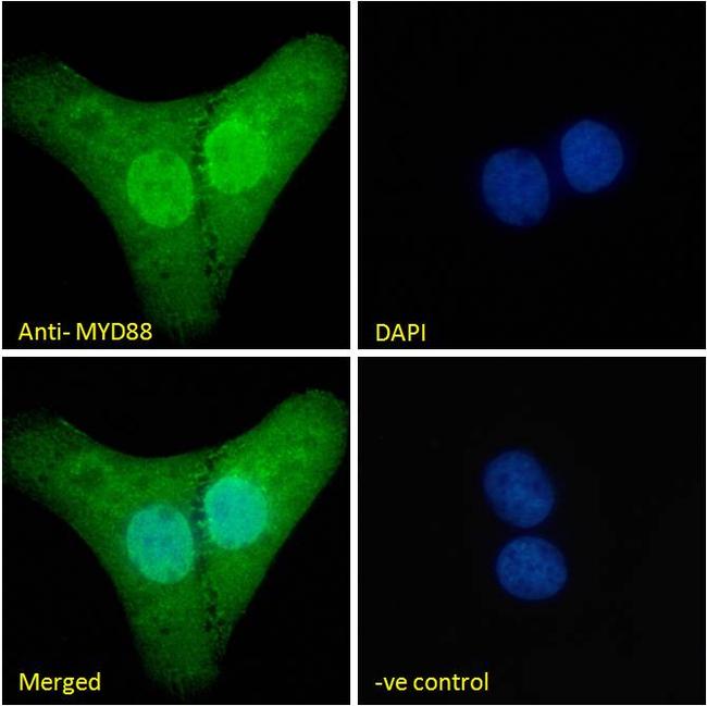 MyD88 Antibody in Immunocytochemistry (ICC/IF)