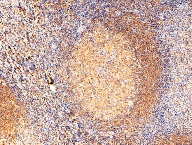 RAC2 Antibody in Immunohistochemistry (Paraffin) (IHC (P))