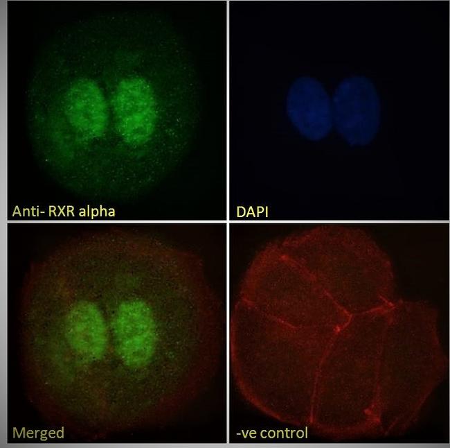 RXRA Antibody in Immunocytochemistry (ICC/IF)