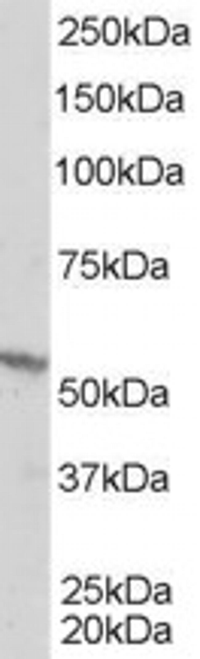 RXRB Antibody in Western Blot (WB)