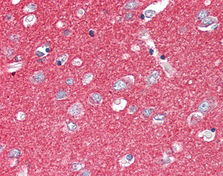 SNAP25 Antibody in Immunohistochemistry (Paraffin) (IHC (P))