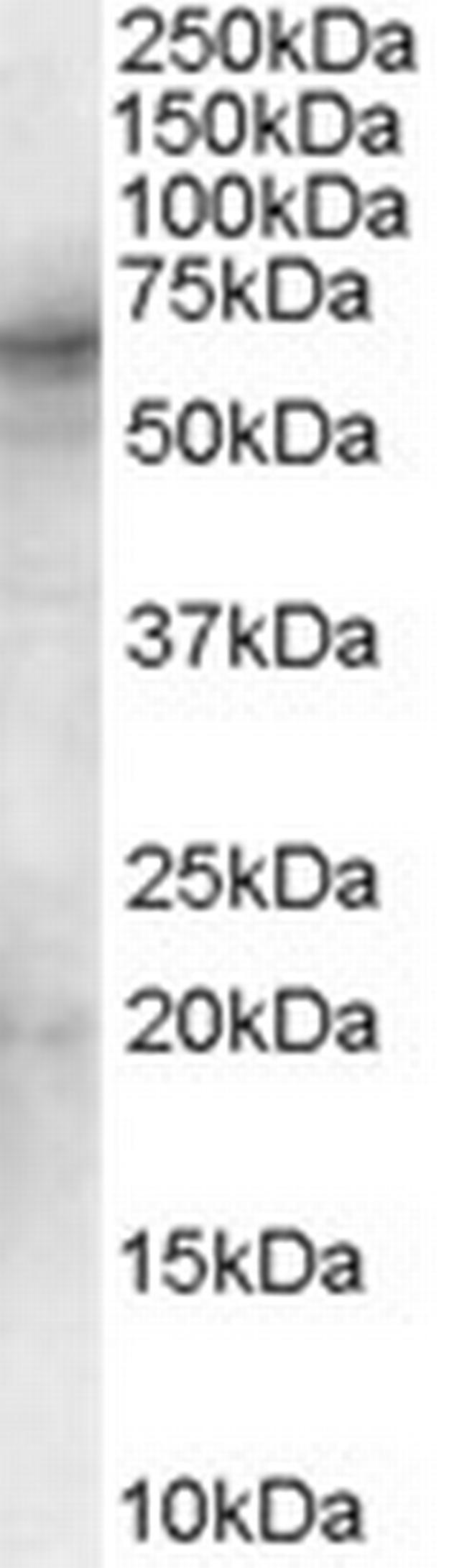 Syk Antibody in Western Blot (WB)