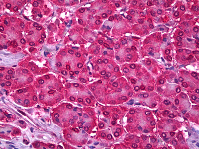 UBC9 Antibody in Immunohistochemistry (Paraffin) (IHC (P))