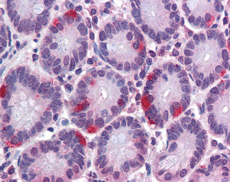 SAR1A Antibody in Immunohistochemistry (Paraffin) (IHC (P))