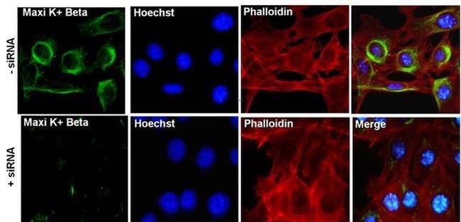 KCNMB1 Antibody in Immunocytochemistry (ICC/IF)