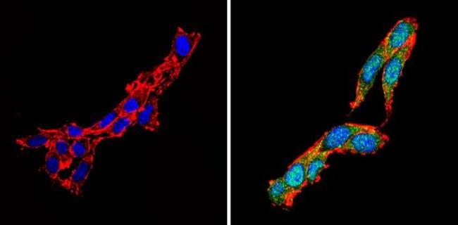 Calcium Sensing Receptor Antibody in Immunocytochemistry (ICC/IF)