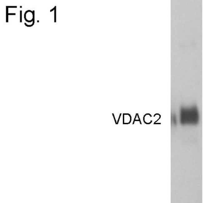 VDAC2 Antibody in Western Blot (WB)