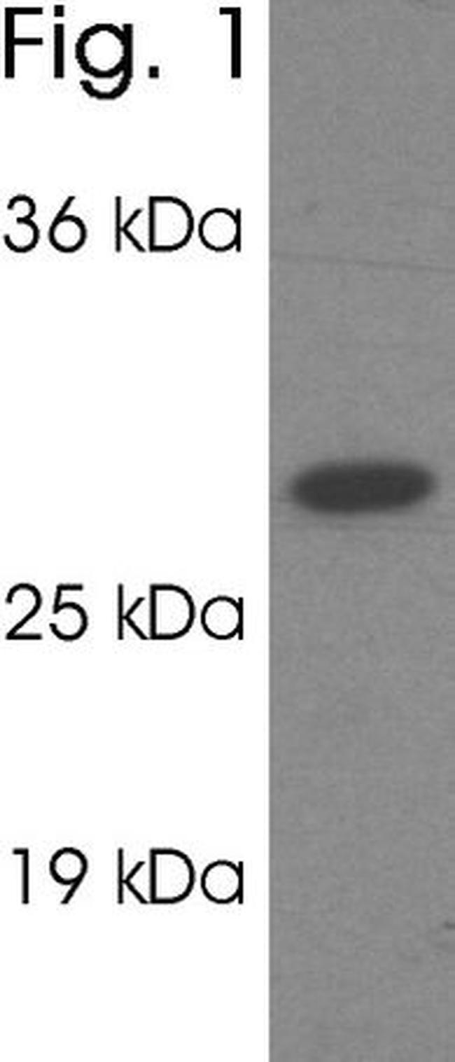 PSME1 Antibody in Western Blot (WB)