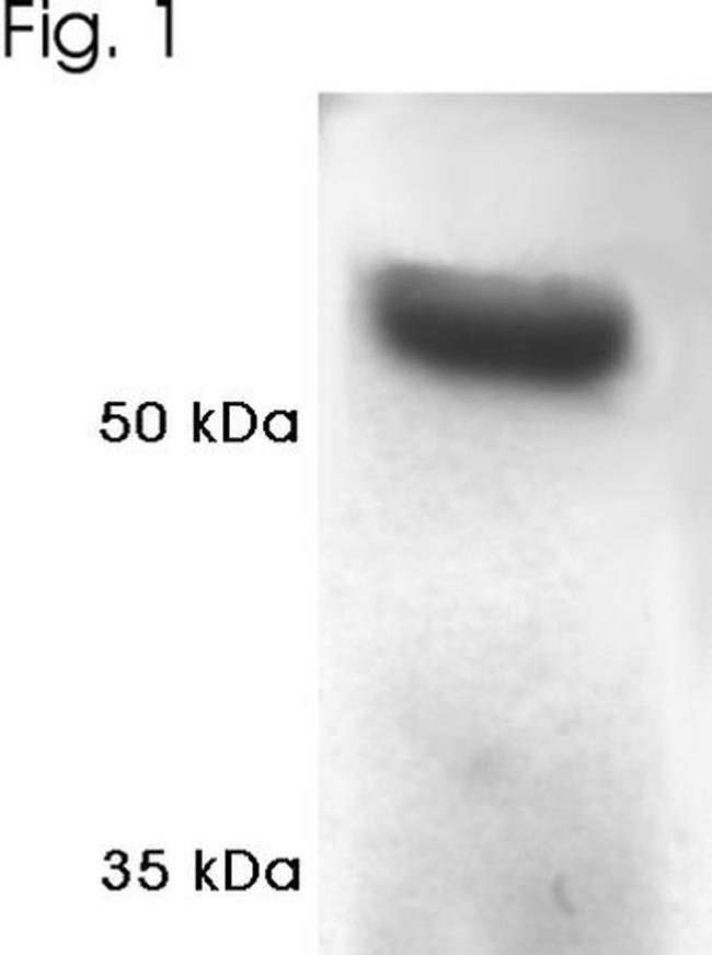 PSMC1 Antibody in Western Blot (WB)