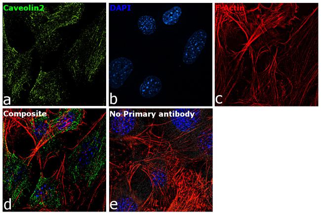 Caveolin 2 Antibody in Immunocytochemistry (ICC/IF)