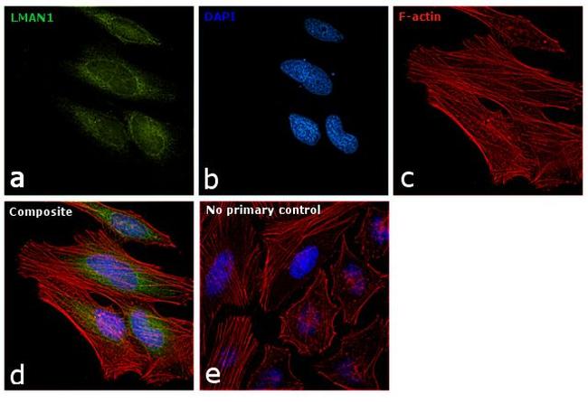 LMAN1 Antibody in Immunocytochemistry (ICC/IF)