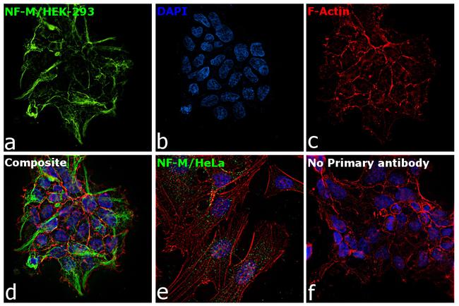 NEFM Antibody in Immunocytochemistry (ICC/IF)