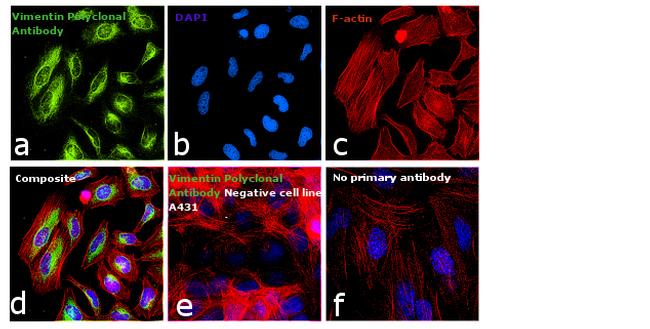 Vimentin Antibody in Immunocytochemistry (ICC/IF)