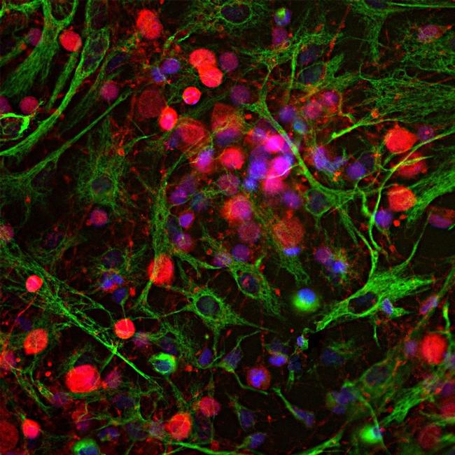 PGP9.5 Antibody in Immunocytochemistry (ICC/IF)