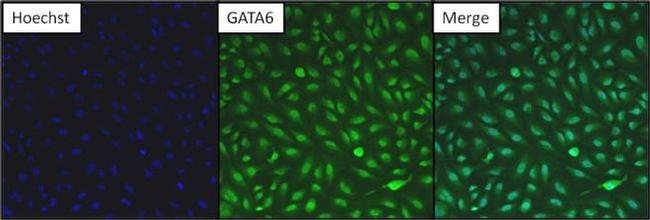 GATA6 Antibody in Immunocytochemistry (ICC/IF)