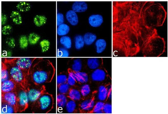 IRS1 Antibody in Immunocytochemistry (ICC/IF)