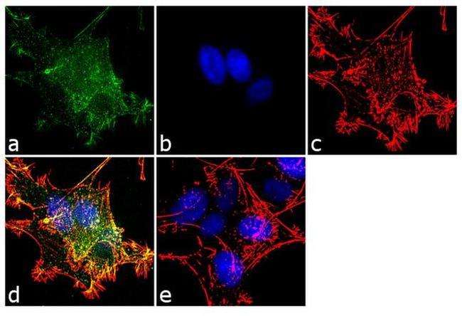 beta-2 Adaptin Antibody in Immunocytochemistry (ICC/IF)