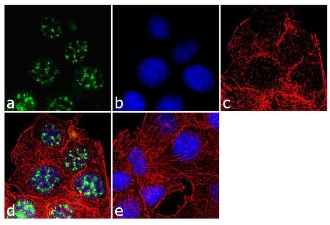 Androgen Receptor Antibody in Immunocytochemistry (ICC/IF)