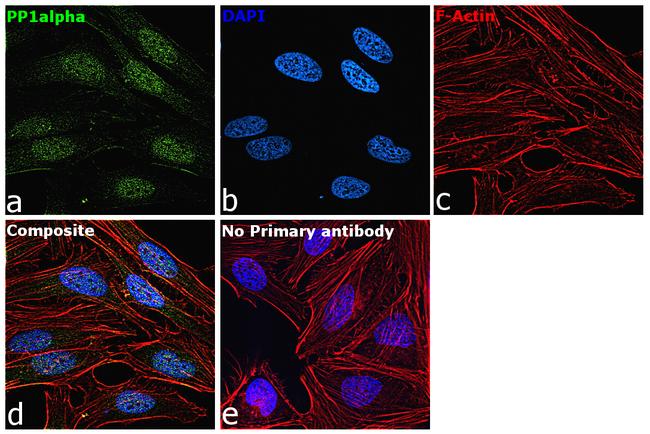 PP1 alpha Antibody in Immunocytochemistry (ICC/IF)