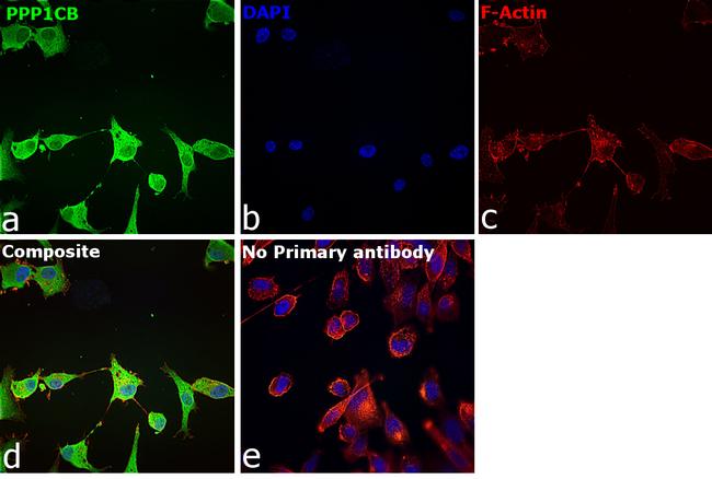 PP1 beta Antibody in Immunocytochemistry (ICC/IF)