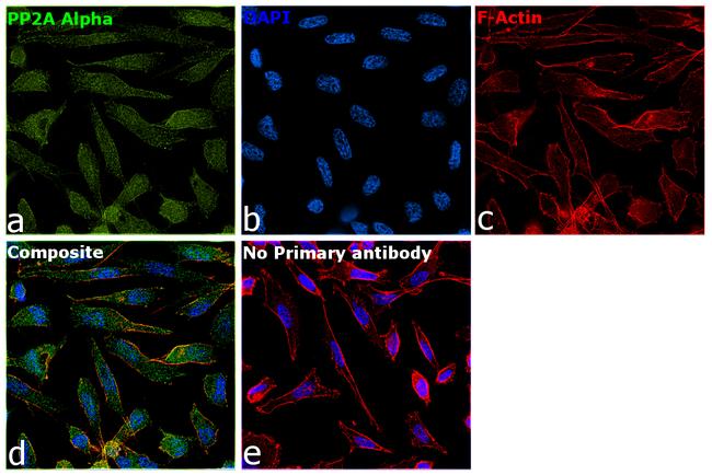 PP2A alpha Antibody in Immunocytochemistry (ICC/IF)