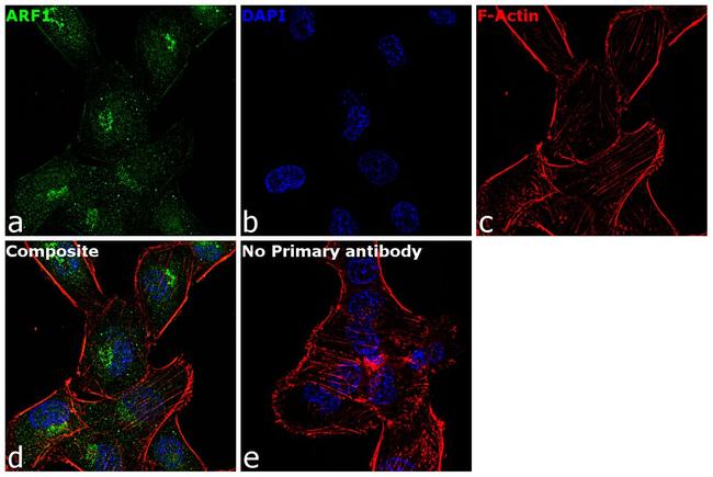 ARF1 Antibody in Immunocytochemistry (ICC/IF)