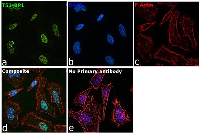 53BP1 Antibody in Immunocytochemistry (ICC/IF)