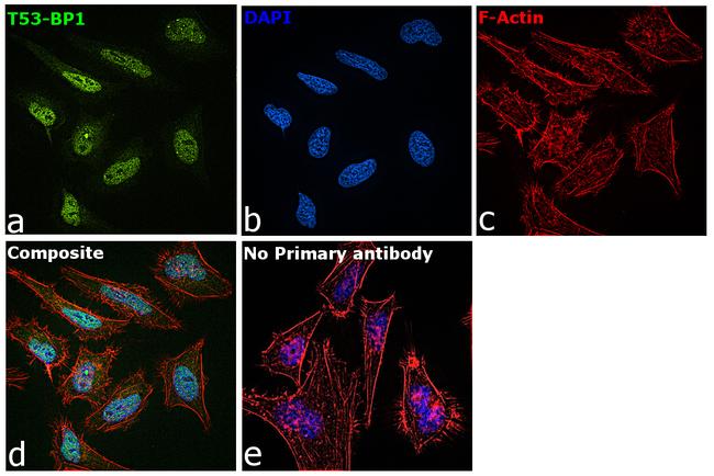 53BP1 Antibody in Immunocytochemistry (ICC/IF)