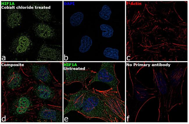 HIF1A Antibody in Immunocytochemistry (ICC/IF)