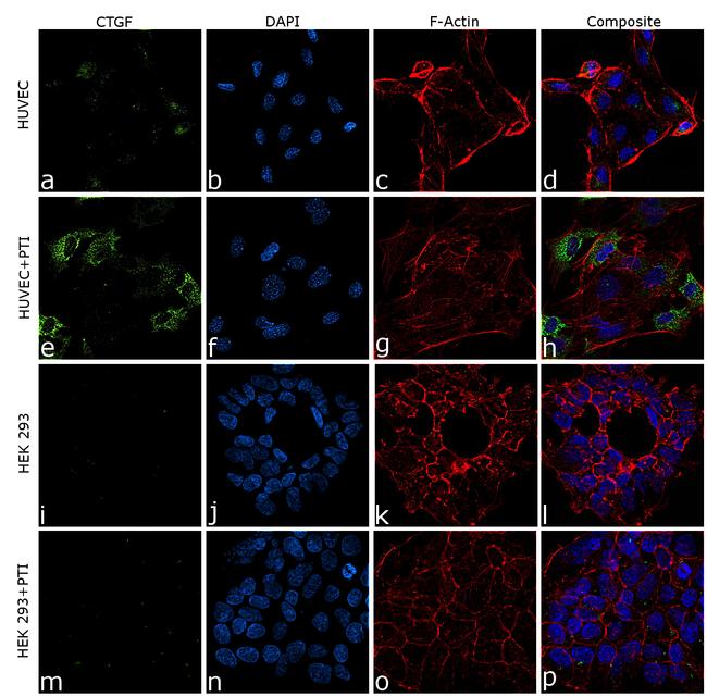 CTGF Antibody in Immunocytochemistry (ICC/IF)