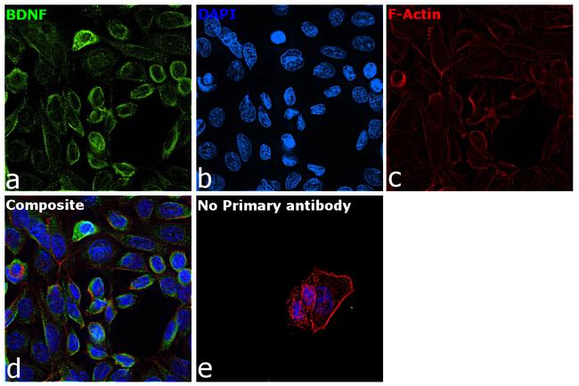 BDNF Antibody in Immunocytochemistry (ICC/IF)