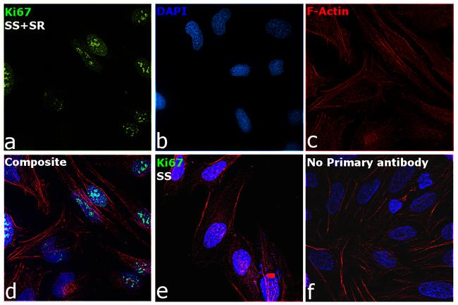 Ki-67 Antibody in Immunocytochemistry (ICC/IF)