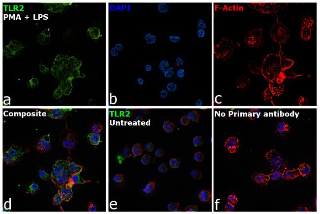 TLR2 Antibody in Immunocytochemistry (ICC/IF)