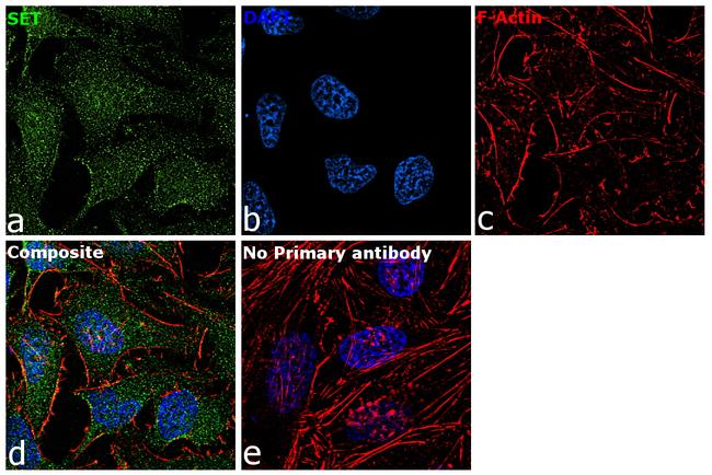 SET Antibody in Immunocytochemistry (ICC/IF)