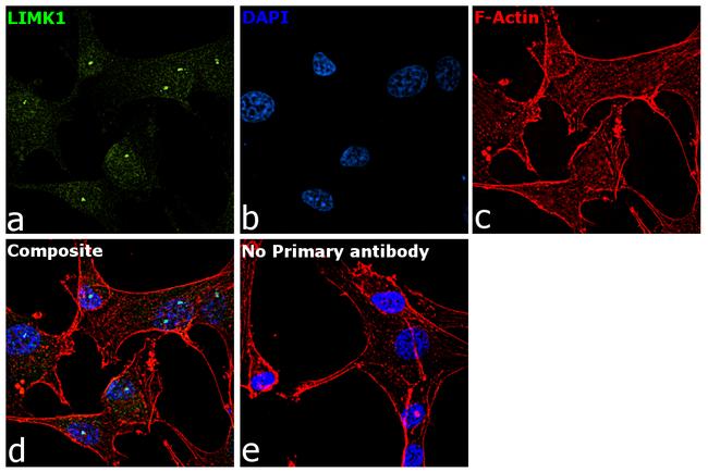 LIMK1 Antibody in Immunocytochemistry (ICC/IF)