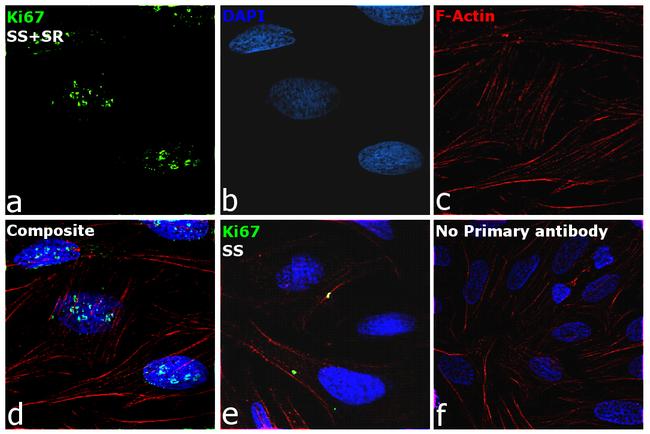 Ki-67 Antibody in Immunocytochemistry (ICC/IF)