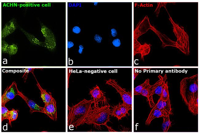 TIM-1 Antibody in Immunocytochemistry (ICC/IF)