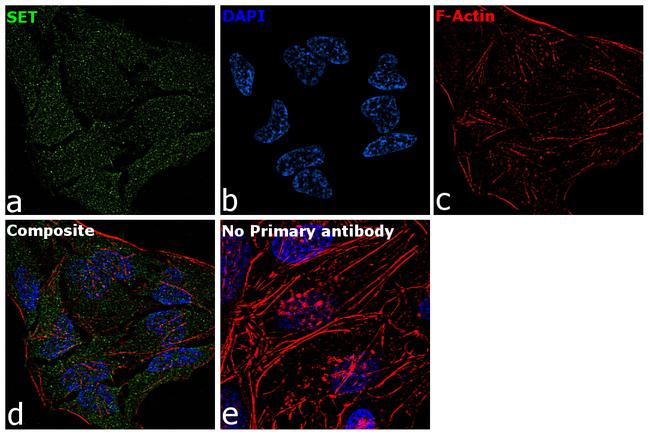 SET Antibody in Immunocytochemistry (ICC/IF)